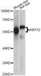 Keratin 12 antibody, A14746, ABclonal Technology, Western Blot image 