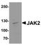 Janus Kinase 2 antibody, A00027-3, Boster Biological Technology, Western Blot image 