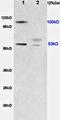Chromaffin granule amine transporter antibody, orb101521, Biorbyt, Western Blot image 