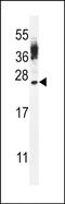 Cancer/testis antigen family 45 member A4/A6 antibody, PA5-48334, Invitrogen Antibodies, Western Blot image 