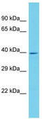 Ankyrin Repeat Domain 16 antibody, TA330657, Origene, Western Blot image 