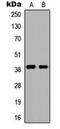 Disintegrin and metalloproteinase domain-containing protein 8 antibody, orb234794, Biorbyt, Western Blot image 