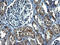 Methyltransferase Like 25 antibody, M17994, Boster Biological Technology, Immunohistochemistry paraffin image 