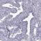 Chromosome 7 Open Reading Frame 61 antibody, PA5-63854, Invitrogen Antibodies, Immunohistochemistry frozen image 
