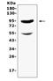 Endoglin antibody, A02997-2, Boster Biological Technology, Western Blot image 