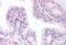 ETS Transcription Factor ERG antibody, GTX89421, GeneTex, Immunohistochemistry paraffin image 