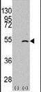 Elongator Acetyltransferase Complex Subunit 3 antibody, PA5-11252, Invitrogen Antibodies, Western Blot image 