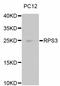 Ribosomal Protein S3 antibody, STJ112995, St John