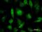 Pre-mRNA-processing factor 19 antibody, H00027339-M07, Novus Biologicals, Immunocytochemistry image 
