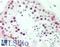 Metastasis Associated 1 antibody, LS-B11291, Lifespan Biosciences, Immunohistochemistry frozen image 