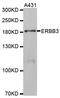 Receptor tyrosine-protein kinase erbB-3 antibody, TA332752, Origene, Western Blot image 