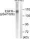 EGFR antibody, TA312535, Origene, Western Blot image 