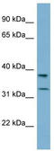 Ral GEF With PH Domain And SH3 Binding Motif 2 antibody, TA344942, Origene, Western Blot image 