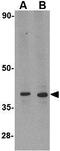 Probable ATP-dependent RNA helicase DHX58 antibody, GTX16995, GeneTex, Western Blot image 