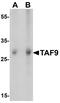 Adenylate Kinase 6 antibody, A05319, Boster Biological Technology, Western Blot image 