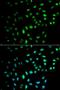 Transforming Growth Factor Beta 1 Induced Transcript 1 antibody, orb324475, Biorbyt, Immunocytochemistry image 