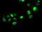 SATB Homeobox 1 antibody, NBP1-47950, Novus Biologicals, Immunocytochemistry image 