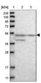 Dual specificity protein phosphatase 12 antibody, NBP1-84961, Novus Biologicals, Western Blot image 