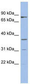 S-acyl fatty acid synthase thioesterase, medium chain antibody, TA335986, Origene, Western Blot image 