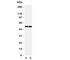 C-C Motif Chemokine Receptor 3 antibody, R31297, NSJ Bioreagents, Western Blot image 