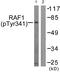 Raf-1 Proto-Oncogene, Serine/Threonine Kinase antibody, AP55703PU-S, Origene, Western Blot image 