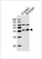 p65 antibody, orb223997, Biorbyt, Western Blot image 