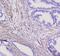 Enolase 2 antibody, A02930, Boster Biological Technology, Immunohistochemistry paraffin image 