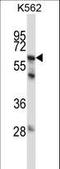 Stromelysin-3 antibody, LS-C164233, Lifespan Biosciences, Western Blot image 