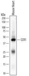 C-C Motif Chemokine Receptor 1 antibody, MAB5986, R&D Systems, Western Blot image 