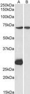 CPT2 antibody, GTX88067, GeneTex, Western Blot image 