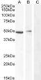 Forkhead Box O4 antibody, 45-623, ProSci, Enzyme Linked Immunosorbent Assay image 