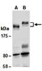 Laminin Subunit Gamma 1 antibody, orb66944, Biorbyt, Western Blot image 