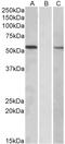 Mannosyl (Alpha-1,3-)-Glycoprotein Beta-1,2-N-Acetylglucosaminyltransferase antibody, LS-C139635, Lifespan Biosciences, Western Blot image 