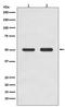AP2M1 antibody, M06179, Boster Biological Technology, Western Blot image 
