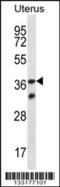 Olfactory Receptor Family 4 Subfamily X Member 2 (Gene/Pseudogene) antibody, 56-961, ProSci, Western Blot image 