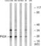Phosphatidylinositol Glycan Anchor Biosynthesis Class X antibody, LS-C120215, Lifespan Biosciences, Western Blot image 