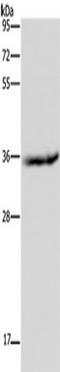 Hydroxysteroid 17-Beta Dehydrogenase 6 antibody, TA350063, Origene, Western Blot image 
