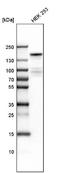 Lysine Demethylase 6A antibody, NBP1-80628, Novus Biologicals, Western Blot image 