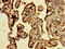 Chromosome 3 Open Reading Frame 14 antibody, CSB-PA884512LA01HU, Cusabio, Immunohistochemistry paraffin image 