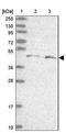 DDB1 And CUL4 Associated Factor 12 Like 2 antibody, NBP2-33428, Novus Biologicals, Western Blot image 