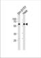 Histone deacetylase 2 antibody, TA325112, Origene, Western Blot image 