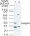 CD207 Molecule antibody, TA336470, Origene, Western Blot image 