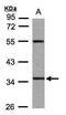 Pantothenate Kinase 3 antibody, PA5-28657, Invitrogen Antibodies, Western Blot image 