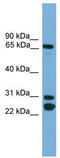 Dynein intermediate chain 2, axonemal antibody, TA329467, Origene, Western Blot image 