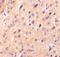CER antibody, NBP1-77239, Novus Biologicals, Immunohistochemistry paraffin image 