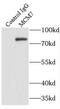 Minichromosome Maintenance Complex Component 7 antibody, FNab05062, FineTest, Immunoprecipitation image 