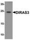 DIRAS Family GTPase 3 antibody, A06954, Boster Biological Technology, Western Blot image 