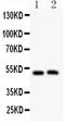 Major Intrinsic Protein Of Lens Fiber antibody, PA2110, Boster Biological Technology, Western Blot image 