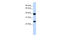 H2A Histone Family Member Y antibody, 27-151, ProSci, Western Blot image 
