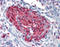 S100 Calcium Binding Protein A4 antibody, TA318024, Origene, Immunohistochemistry paraffin image 